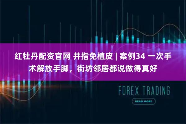 红牡丹配资官网 并指免植皮 | 案例34 一次手术解放手脚,街坊邻居都说做得真好